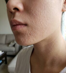 Korean body lotion for dry skin